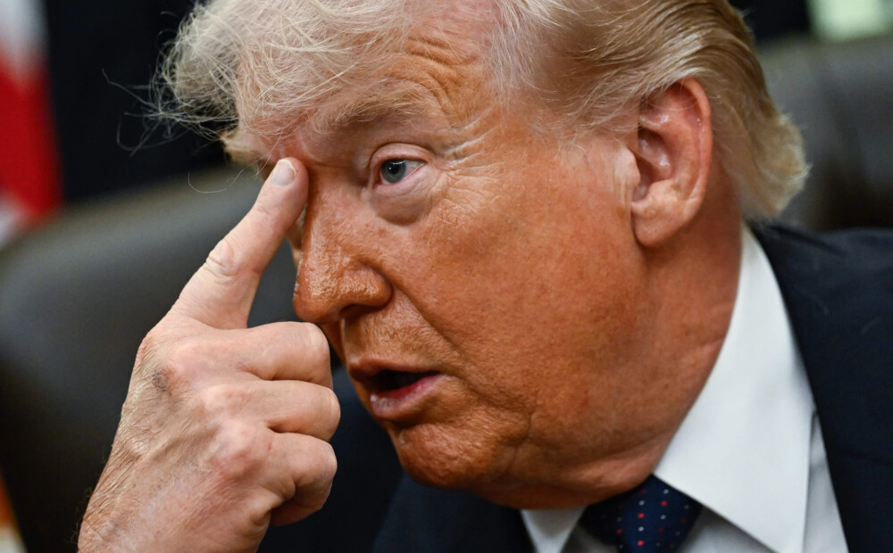 Donalda Trampa veselība lupā: izcili rādītāji, bet ārsti brīdina par lieko svaru